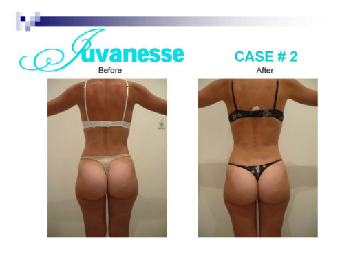 Before-and-After-Presentation-2_Page_06-510×382
